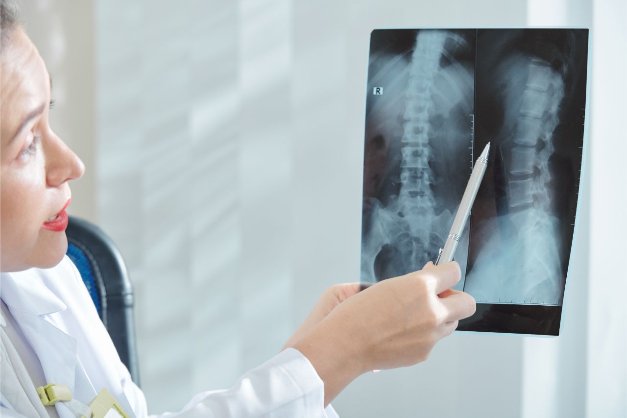 Spine xray and chiropractor