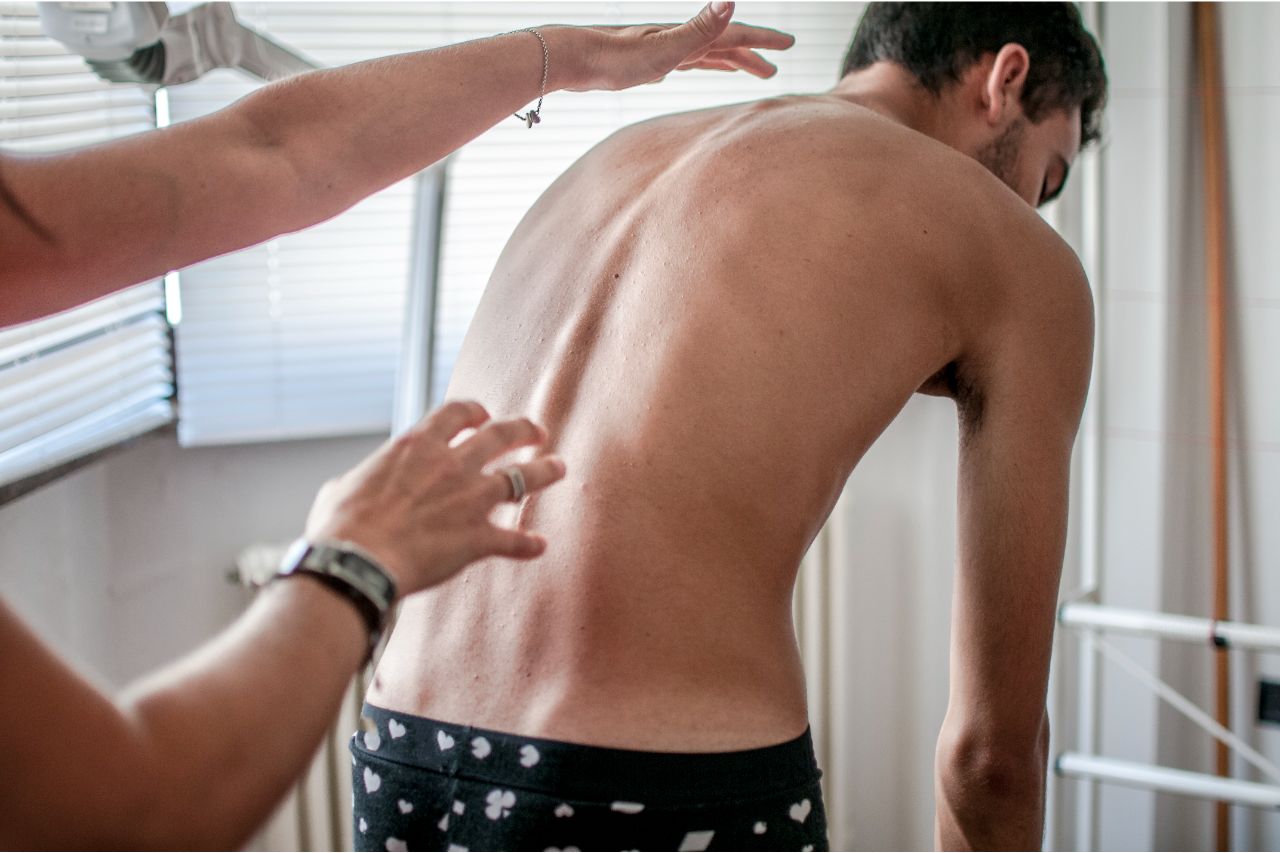 Can Chiropractors Cure Scoliosis?